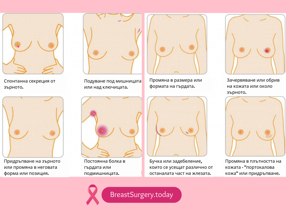 скрининг за рак на гърдата - самоизследване